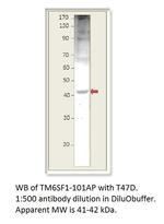 TM6SF1 Polyclonal Antibody