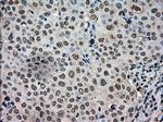 TMEM100 Antibody in Immunohistochemistry (Paraffin) (IHC (P))