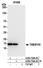 TMEM109 Antibody in Western Blot (WB)