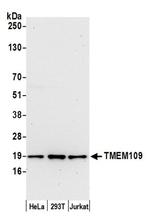 TMEM109 Polyclonal Antibody