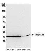 TMEM109 Polyclonal Antibody