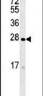 TMEM134 Antibody in Western Blot (WB)