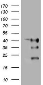 TMEM173 Antibody in Western Blot (WB)