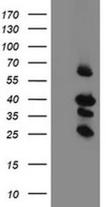 TMEM173 Antibody in Western Blot (WB)