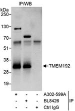 TMEM192 Antibody in Immunoprecipitation (IP)