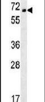 TMEM214 Antibody in Western Blot (WB)