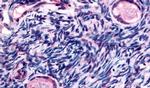 TMEM5 Antibody in Immunohistochemistry (Paraffin) (IHC (P))