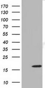TMEM80 Antibody in Western Blot (WB)