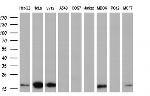 TMEM80 Antibody in Western Blot (WB)