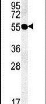 TMEM79 Antibody in Western Blot (WB)
