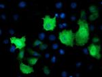 TMOD1 Antibody in Immunocytochemistry (ICC/IF)