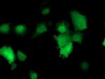 TMOD1 Antibody in Immunocytochemistry (ICC/IF)