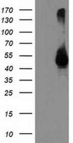 TMPRSS5 Antibody in Western Blot (WB)