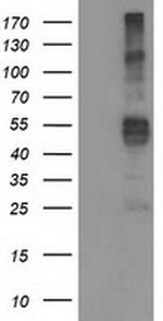 TMPRSS5 Antibody in Western Blot (WB)