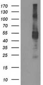 TMPRSS5 Antibody in Western Blot (WB)