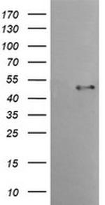 TMPRSS5 Antibody in Western Blot (WB)