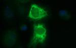 TMX1 Antibody in Immunocytochemistry (ICC/IF)