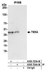 TMX4 Polyclonal Antibody