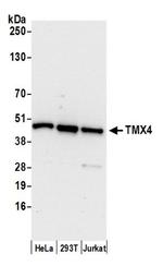 TMX4 Polyclonal Antibody