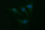 TNFA Antibody in Immunocytochemistry (ICC/IF)