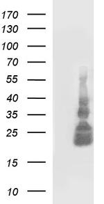 TNFA Antibody in Western Blot (WB)