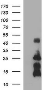 TNFA Antibody in Western Blot (WB)