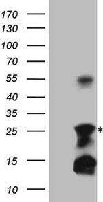 TNFA Antibody in Western Blot (WB)