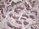 TNFRSF10B Antibody in Immunohistochemistry (Paraffin) (IHC (P))