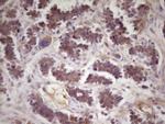 TNFRSF10B Antibody in Immunohistochemistry (Paraffin) (IHC (P))