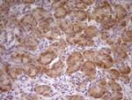 TNFRSF10B Antibody in Immunohistochemistry (Paraffin) (IHC (P))