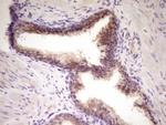 TNFRSF10B Antibody in Immunohistochemistry (Paraffin) (IHC (P))