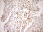 TNFRSF10B Antibody in Immunohistochemistry (Paraffin) (IHC (P))
