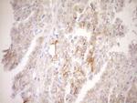 TNFRSF10B Antibody in Immunohistochemistry (Paraffin) (IHC (P))