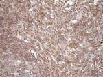 TNFRSF10B Antibody in Immunohistochemistry (Paraffin) (IHC (P))