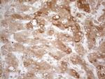 TNFRSF10B Antibody in Immunohistochemistry (Paraffin) (IHC (P))