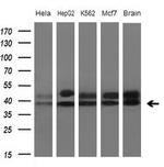 TNFRSF10B Antibody in Western Blot (WB)