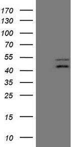 TNFRSF10B Antibody in Western Blot (WB)