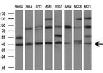 TNFRSF10B Antibody in Western Blot (WB)