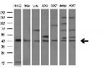 TNFRSF10B Antibody in Western Blot (WB)