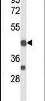 CD264 (TRAIL-R4) Antibody in Western Blot (WB)