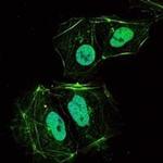 TNFRSF11B Monoclonal Antibody (5G2)