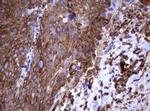 TNFRSF8 Antibody in Immunohistochemistry (Paraffin) (IHC (P))