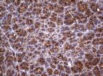 TNFRSF8 Antibody in Immunohistochemistry (Paraffin) (IHC (P))