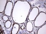 TNFRSF8 Antibody in Immunohistochemistry (Paraffin) (IHC (P))