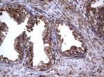 TNFRSF8 Antibody in Immunohistochemistry (Paraffin) (IHC (P))
