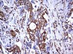 TNFRSF8 Antibody in Immunohistochemistry (Paraffin) (IHC (P))