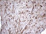 TNFRSF8 Antibody in Immunohistochemistry (Paraffin) (IHC (P))
