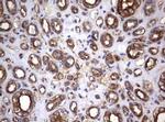 TNFRSF8 Antibody in Immunohistochemistry (Paraffin) (IHC (P))