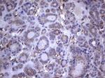 TNFRSF8 Antibody in Immunohistochemistry (Paraffin) (IHC (P))