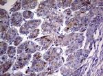 TNFRSF8 Antibody in Immunohistochemistry (Paraffin) (IHC (P))